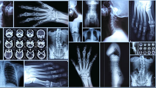ITC Teleradiology | X-ray Montage